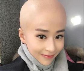 光头偶像明星,闪耀舞台的时尚传奇